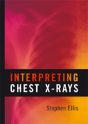Interpreting Chest X-Rays - Preview