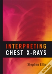Capa do artigo Interpreting Chest X-Rays
