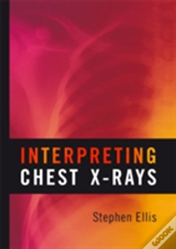 Capa do artigo Interpreting Chest X-Rays
