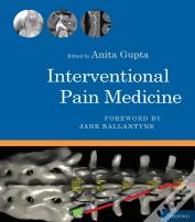 Interventional Pain Medicine