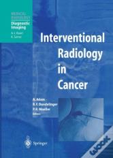 Interventional Radiology In Cancer