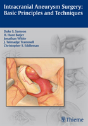Intracranial Aneurysm Surgery - Preview