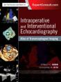 Intraoperative And Interventional Echocardiography - Preview