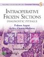 Intraoperative Frozen Sections: Diagnostic Pitfalls - Preview