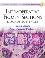 Capa do artigo Intraoperative Frozen Sections