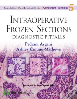 Capa do artigo Intraoperative Frozen Sections