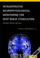 Intraoperative Neurophysiological Monitoring For Deep Brain Stimulation
