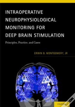 Capa do artigo Intraoperative Neurophysiological Monitoring For Deep Brain Stimulation