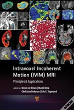 Capa do artigo Intravoxel Incoherent Motion (Ivim) Mri
