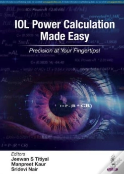 Capa do artigo Iol Power Calculation Made Easy