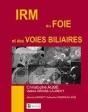 Irm Du Foie Et Des Voies Biliaires - Preview