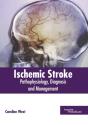 Ischemic Stroke - Preview