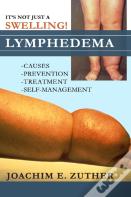 It'S Not Just A Swelling! Lymphedema