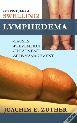 Capa do artigo It'S Not Just A Swelling! Lymphedema