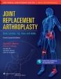Joint Replacement Arthroplasty - Preview