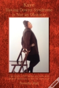 Capa do artigo Kaye Having Downs Syndrome Is Not An Obstacle