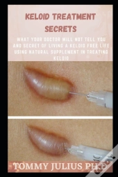 Keloid Treatment Secrets
