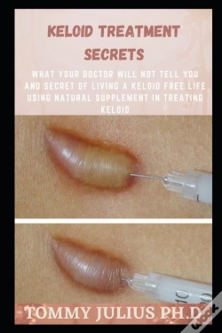 Capa do artigo Keloid Treatment Secrets