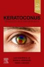 Keratoconus - Preview
