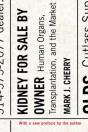 Kidney For Sale By Owner - Preview