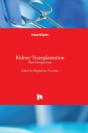 Kidney Transplantation - Preview