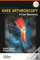 Knee Arthroscopy