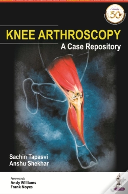 Capa do artigo Knee Arthroscopy