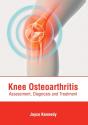 Knee Osteoarthritis: Assessment, Diagnos - Preview