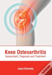 Knee Osteoarthritis: Assessment, Diagnos