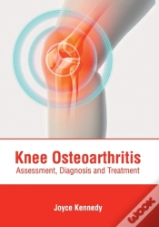 Capa do artigo Knee Osteoarthritis: Assessment, Diagnos