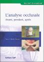 L Analyse Occlusale Avant Pendant Apres - Preview
