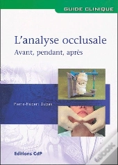 L Analyse Occlusale Avant Pendant Apres