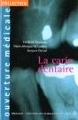 La Carie Dentaire - Preview