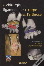 Capa do artigo La Chirurgie Ligamentaire Du Carpe Avant L