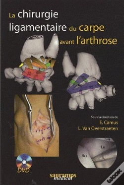 Capa do artigo La Chirurgie Ligamentaire Du Carpe Avant L'Arthrose
