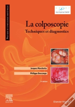 Capa do artigo La Colposcopie