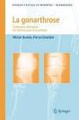 La Gonarthrose ; Traitement Chirurgical : De L'Arthroscopie À La Prothèse - Preview