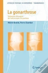 La Gonarthrose ; Traitement Chirurgical : De L'Arthroscopie À La Prothèse