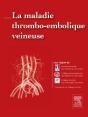 La Maladie Thromboembolique Veineuse - Preview