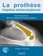 La Prothèse Trapézo-Métacarpienne - Preview