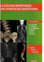 La Scoliose Idiopathique ; Une Approche Multidisciplinaire - Preview