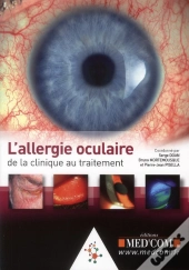L'Allergie Oculaire : De La Clinique Au Traitement