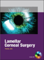 Lamellar Corneal Surgery - Preview