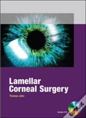 Capa do artigo Lamellar Corneal Surgery