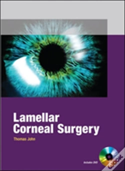 Capa do artigo Lamellar Corneal Surgery