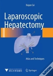 Capa do artigo Laparoscopic Hepatectomy