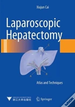 Capa do artigo Laparoscopic Hepatectomy