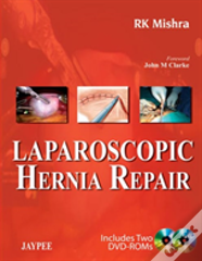 Laparoscopic Hernia Repair