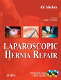 Laparoscopic Hernia Repair - Preview