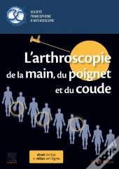 L'Arthroscopie De La Main, Du Poignet Et Du Coude